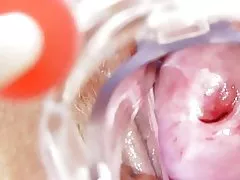 La enfermera cochina se queda เป็น solas